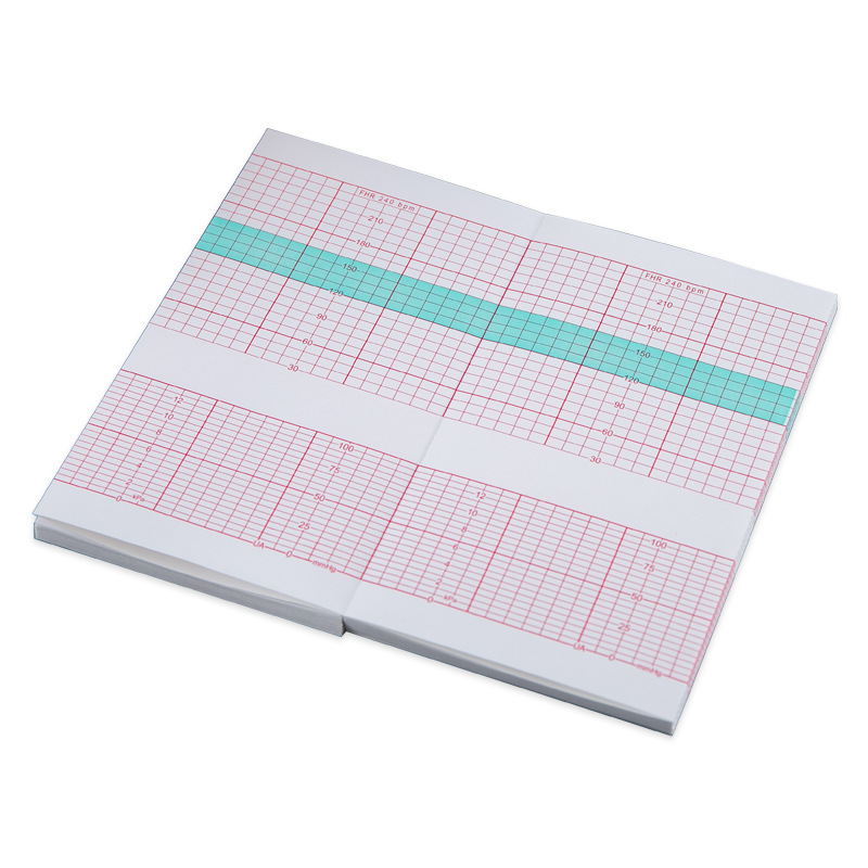 CTG Fetal Monitor Paper