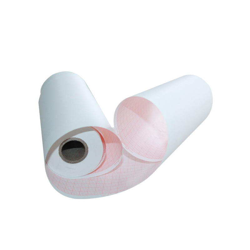 CTG Fetal Monitor Paper