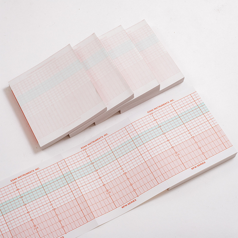CTG Fetal Monitor Paper
